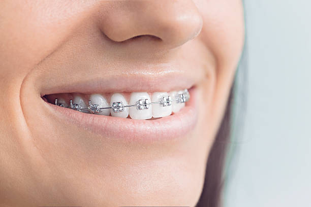 Full Mouth Reconstruction in Netcong, NJ